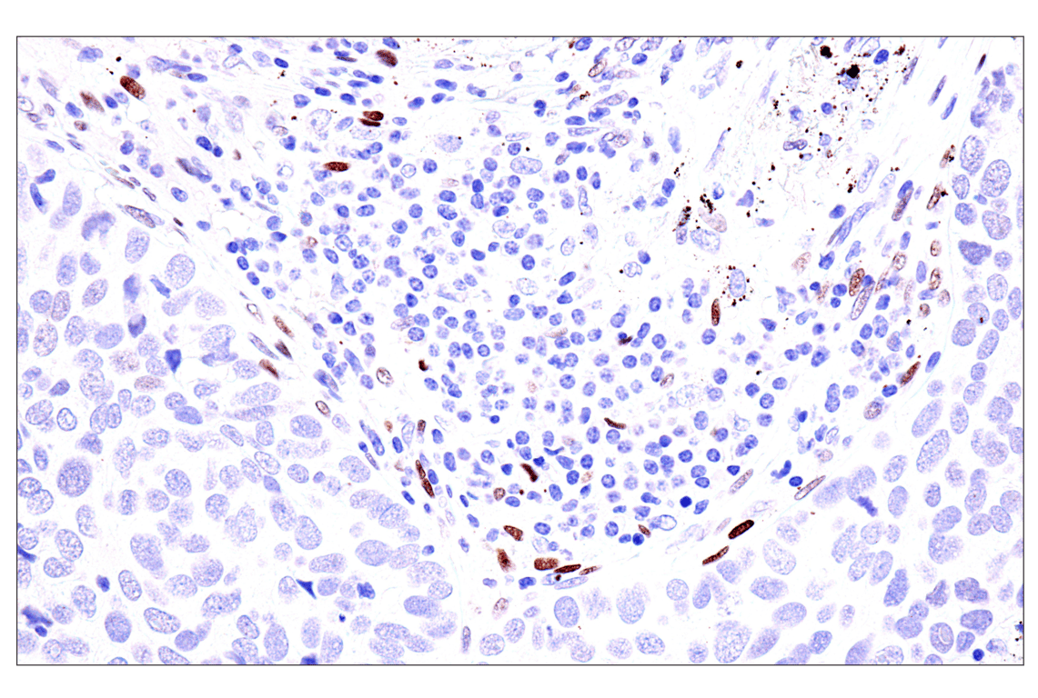 Immunohistochemistry Image 5: GATA-6 (D61E4) XP<sup>®</sup> Rabbit mAb