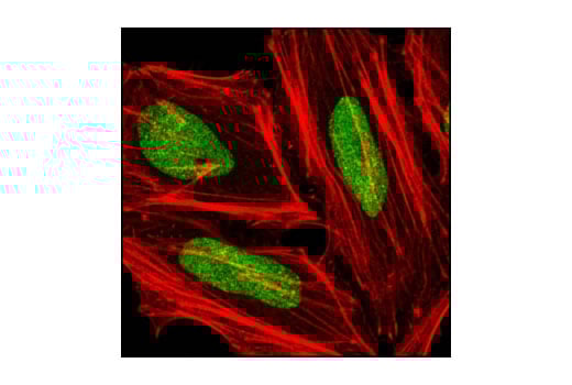 Immunofluorescence Image 1: PIAS1 (D33A7) Rabbit Monoclonal Antibody (BSA and Azide Free)