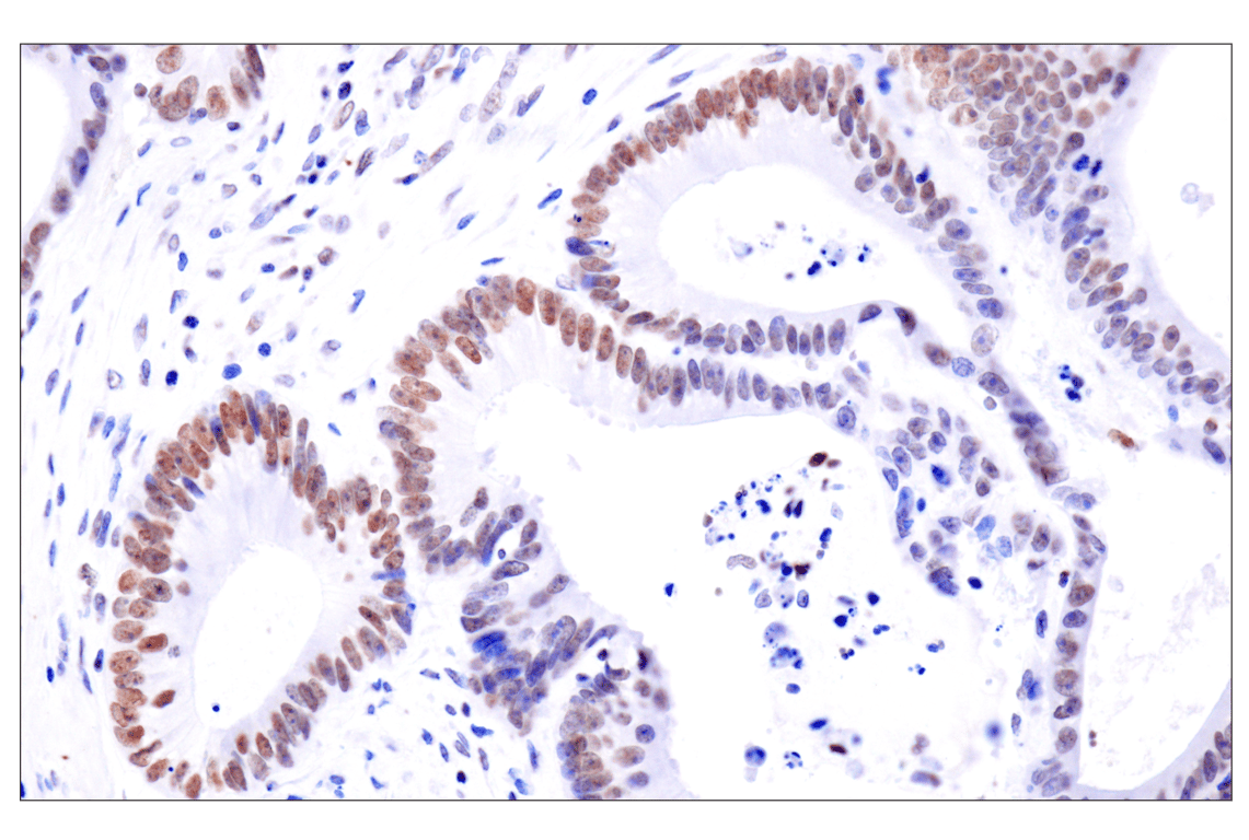 Immunohistochemistry Image 2: Acetyl-Histone H4 (Lys16) (E2B8W) Rabbit Monoclonal Antibody