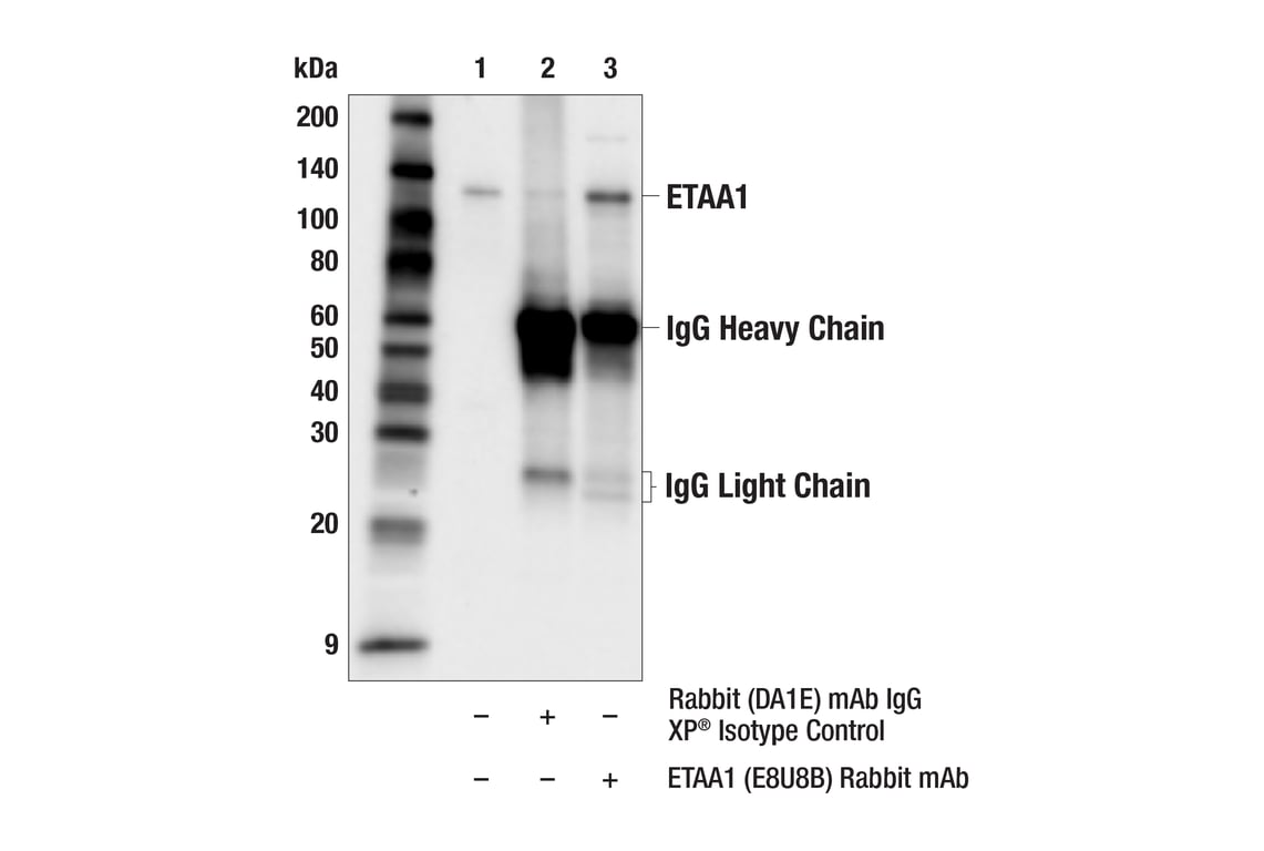 Immunoprecipitation Image 1: ETAA1 (E8U8B) Rabbit Monoclonal Antibody