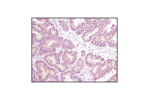 Immunohistochemistry Image 1: Axin1 (C76H11) Rabbit Monoclonal Antibody