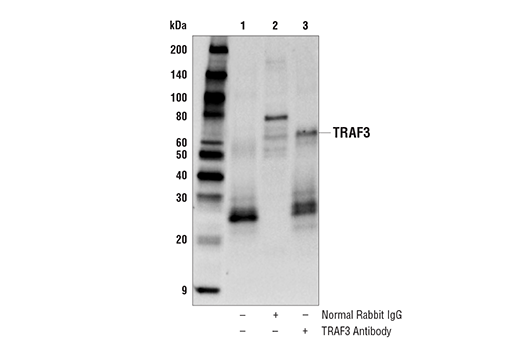 undefined Image 19: NF-kappaB Non-Canonical Pathway Antibody Sampler Kit