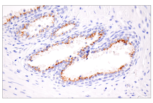 Immunohistochemistry Image 6: Furin (E2Y2F) Rabbit Monoclonal Antibody
