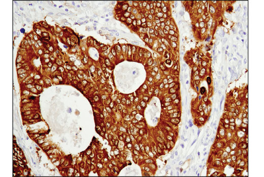 Immunohistochemistry Image 1: ASS1 (D4O4B) Rabbit Monoclonal Antibody