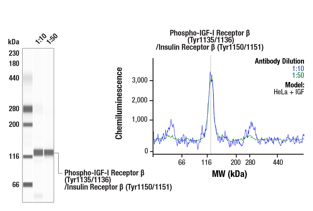 undefined Image 6: Phospho-Insulin/IGF Receptor Antibody Sampler Kit