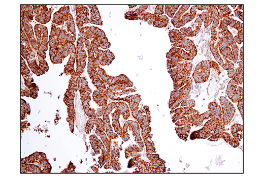 BCAT2 (D8K3O) Rabbit mAb | Cell Signaling Technology