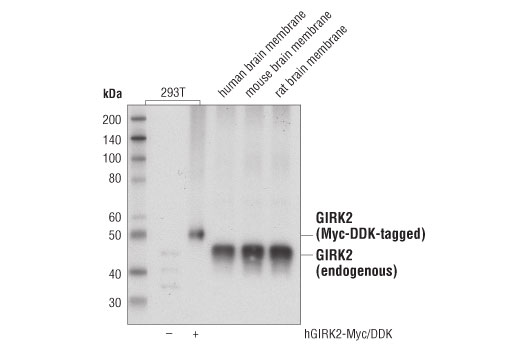 Western Blotting Image 1: GIRK2 (D6C2T) Rabbit mAb