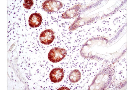 Immunohistochemistry Image 1: CA9 (D47G3) Rabbit Monoclonal Antibody (BSA and Azide Free)