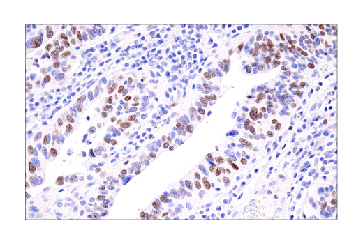 Immunohistochemistry Image 3: ATAD2 (E8Y7F) Rabbit Monoclonal Antibody