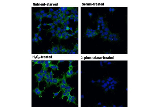 Immunofluorescence Image 1: Phospho-Acetyl-CoA Carboxylase (Ser79) (D7D11) Rabbit mAb (BSA and Azide Free)