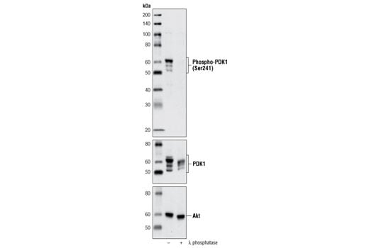 undefined Image 10: Phospho-Akt Pathway Antibody Sampler Kit
