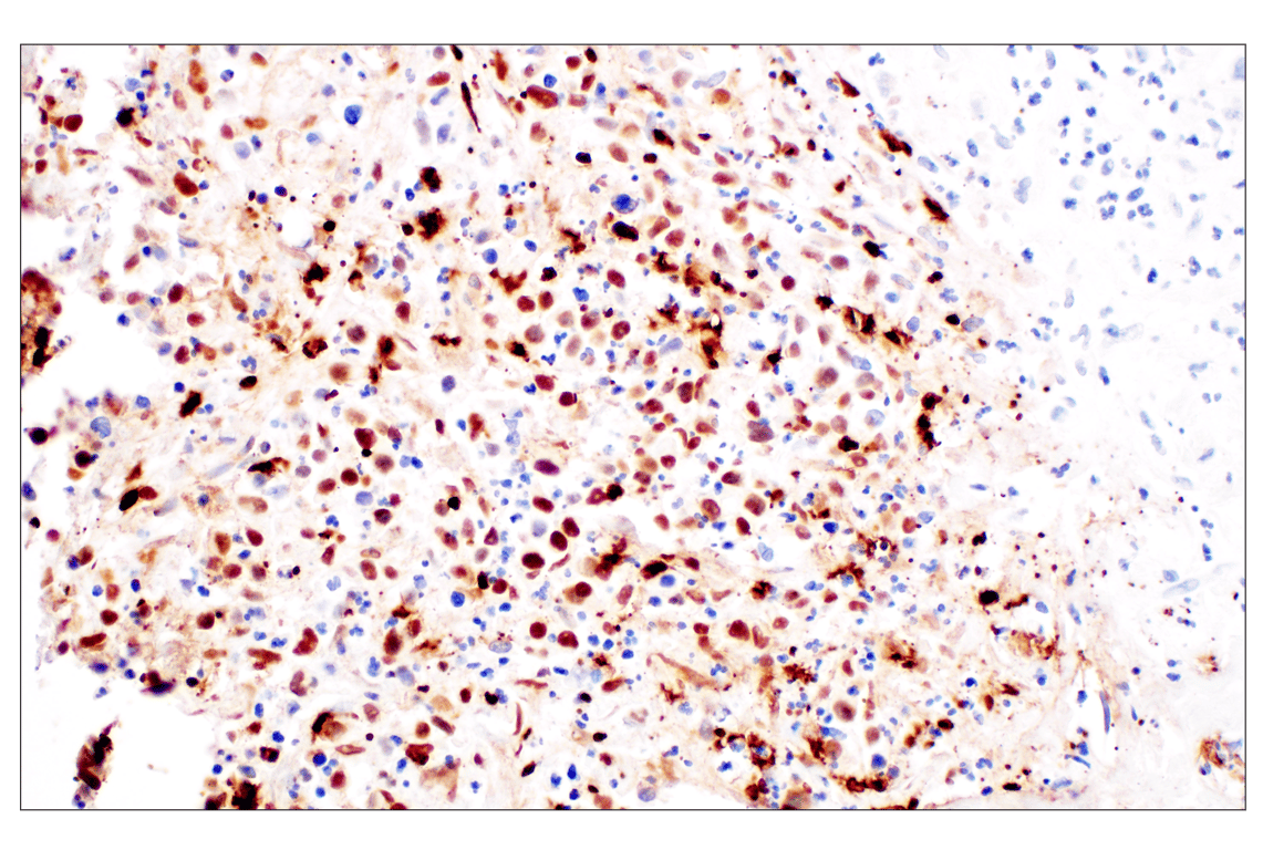 Immunohistochemistry Image 1: Citrullinated Histone H3 (Arg2) (F3C9B) Rabbit mAb (IHC Formulated)