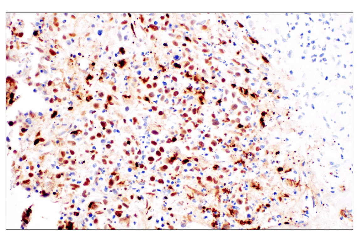 Immunohistochemistry Image 1: Citrullinated Histone H3 (Arg2) (F3C9B) Rabbit mAb (IHC Formulated)