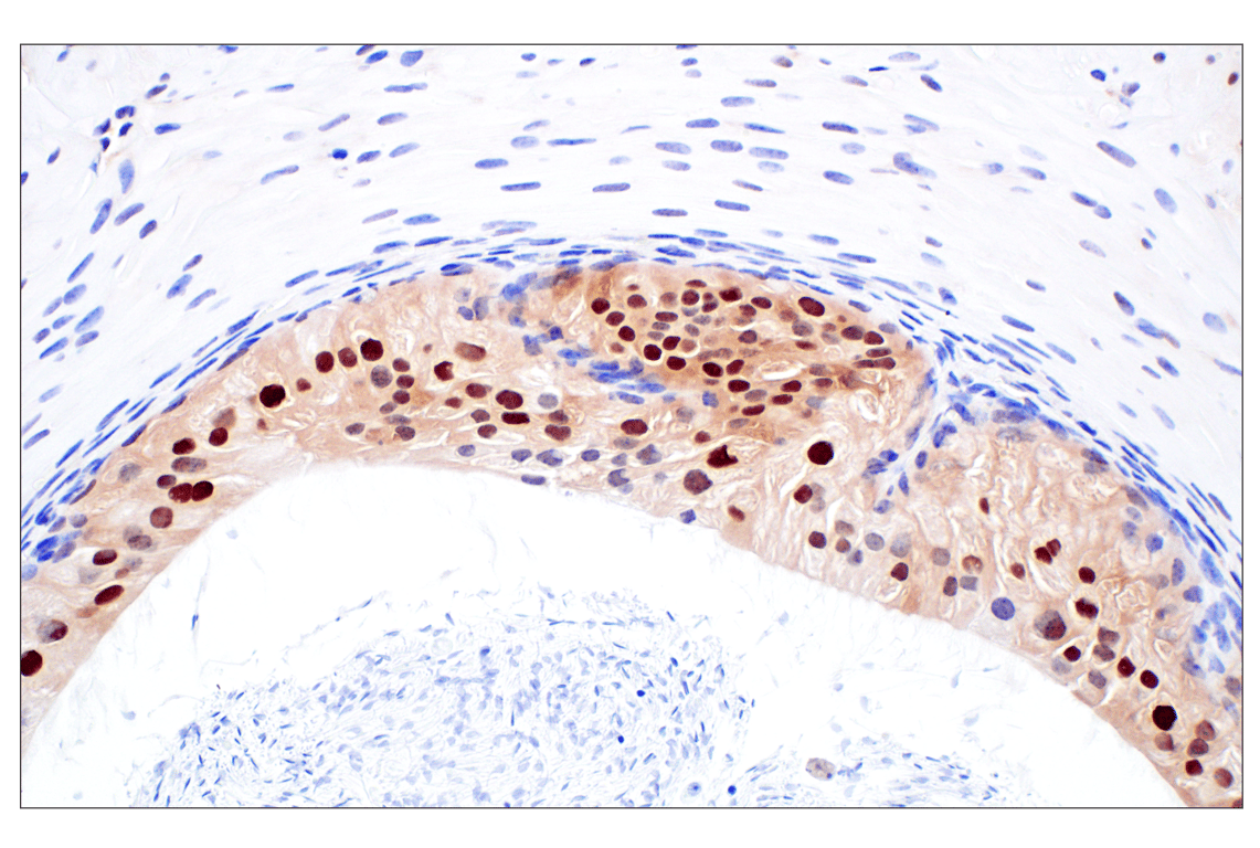 Immunohistochemistry Image 6: CDK4 (F8L5F) Rabbit Monoclonal Antibody