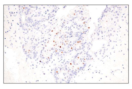 Immunohistochemistry Image 4: p14 ARF (E3X6D) Rabbit mAb (BSA and Azide Free)