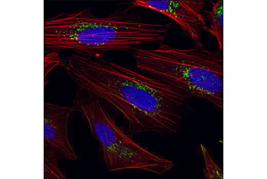 undefined Image 15: Rag and LAMTOR Antibody Sampler Kit
