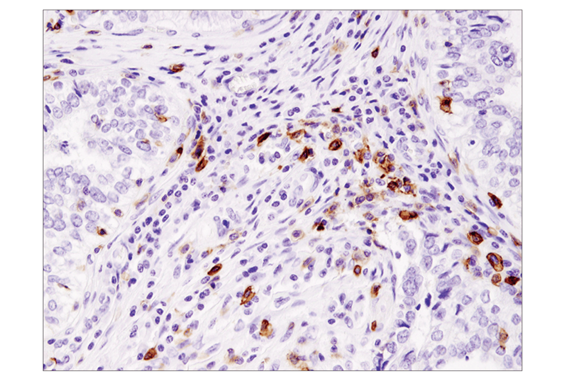 Immunohistochemistry Image 1: ICOS (D1K2T<sup>™</sup>) Rabbit mAb