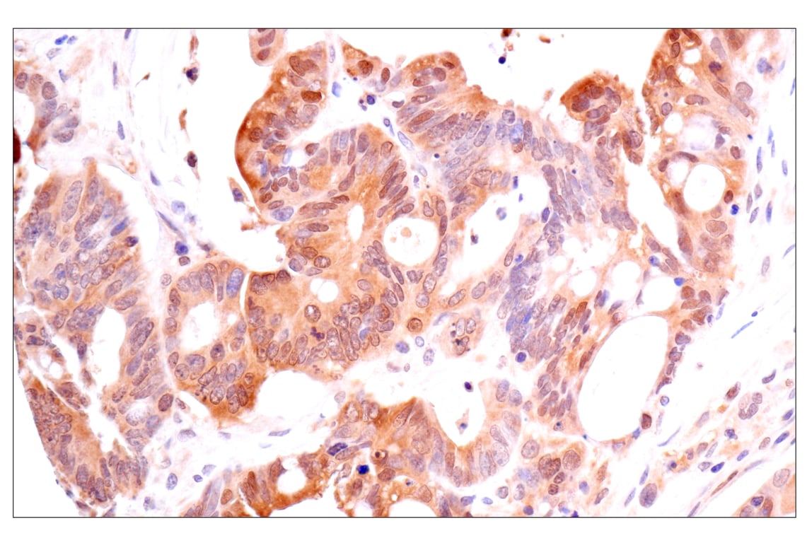 Immunohistochemistry Image 2: ACBP/DBI (E6K8G) Rabbit Monoclonal Antibody