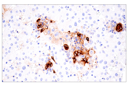 Immunohistochemistry Image 3: CA 19-9 (C241:5:1:4) Mouse Monoclonal Antibody