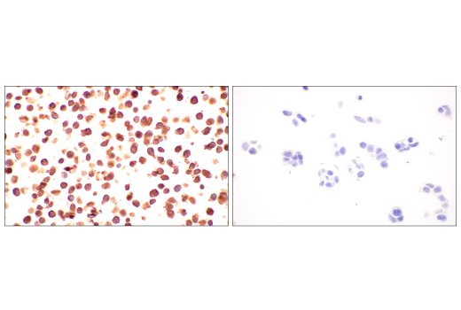 Immunohistochemistry Image 11: p16 INK4A (BC42) Mouse Monoclonal Antibody