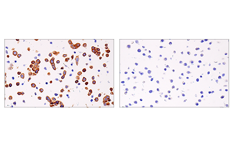undefined Image 41: Apoptosis/Necroptosis Antibody Sampler Kit II