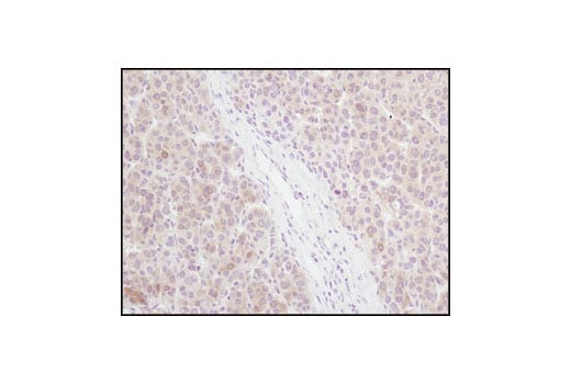 Immunohistochemistry Image 2: 4E-BP1 (53H11) Rabbit Monoclonal Antibody (BSA and Azide Free)