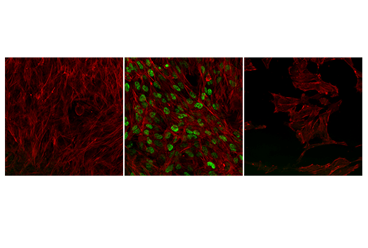 undefined Image 19: p62/KEAP1/NRF2 Pathway Antibody Sampler Kit