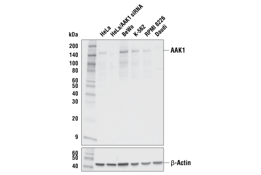 Western Blotting Image 2: AAK1 (E8M3P) Rabbit Monoclonal Antibody