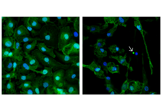 ASC/TMS1 (D2W8U) Rabbit mAb (Alexa Fluor® 647 Conjugate