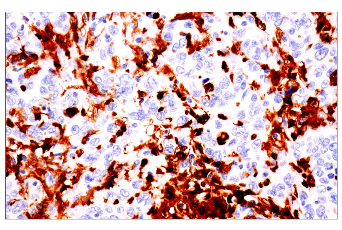 Immunohistochemistry Image 2: p47phox (F3Y6C) Rabbit Monoclonal Antibody (BSA and Azide Free)
