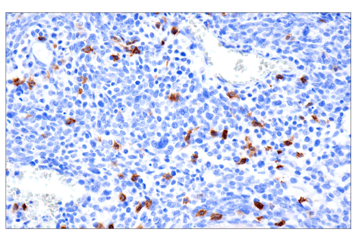Immunohistochemistry Image 2: TRBC1/TCR beta constant region 1 (E6Z3S) Rabbit Monoclonal Antibody