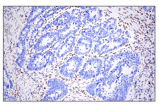 Immunohistochemistry Image 3: ZEB1 (E2G6Y) Rabbit Monoclonal Antibody (BSA and Azide Free)
