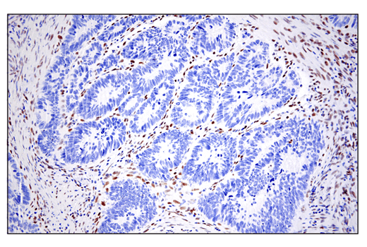 Immunohistochemistry Image 3: ZEB1 (E2G6Y) XP<sup>®</sup> Rabbit mAb (BSA and Azide Free)