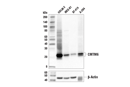 Western Blotting Image 2: CMTM6 (E5B1F) Rabbit Monoclonal Antibody