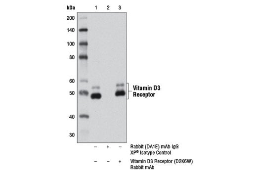 Immunoprecipitation Image 1: Vitamin D3 Receptor (D2K6W) Rabbit Monoclonal Antibody