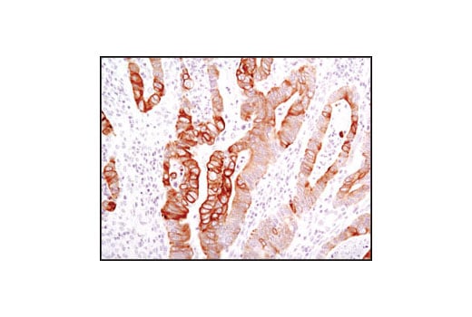 Immunohistochemistry Image 3: Keratin 17/19 (D32D9) Rabbit Monoclonal Antibody
