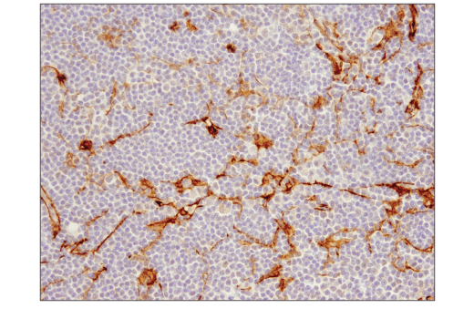 Immunohistochemistry Image 4: RhoB (D1J9V) Rabbit Monoclonal Antibody