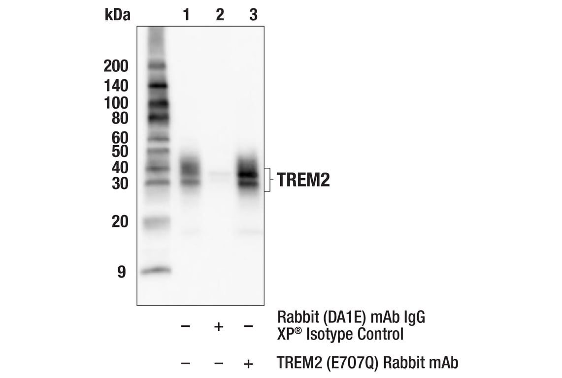Immunoprecipitation Image 1: TREM2 (E7O7Q) Rabbit Monoclonal Antibody