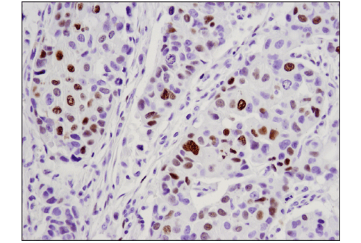 Immunohistochemistry Image 3: WT1 (D8I7F) Rabbit Monoclonal Antibody (BSA and Azide Free)