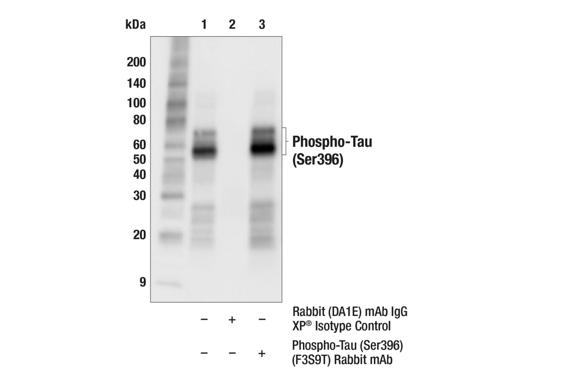Immunoprecipitation Image 1: Phospho-Tau (Ser396) (F3S9T) Rabbit Monoclonal Antibody