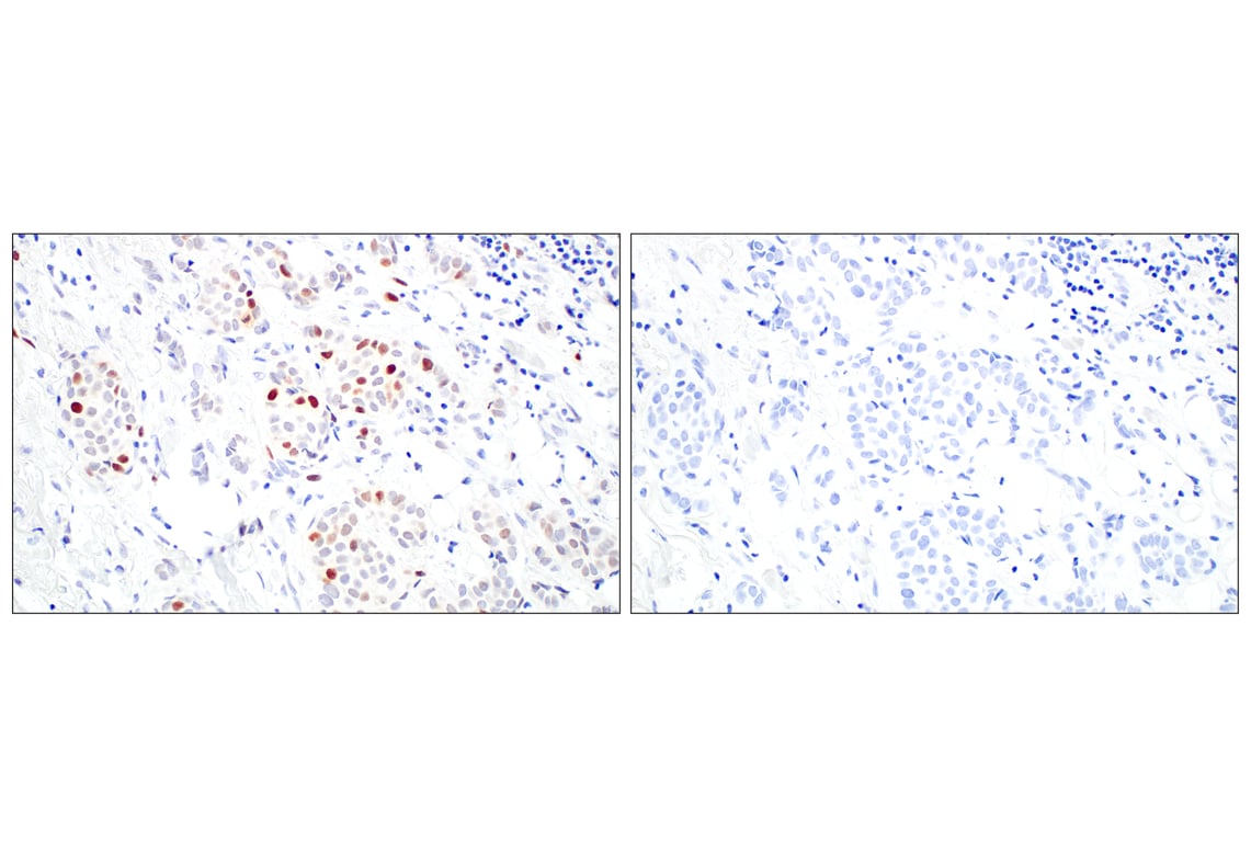 Immunohistochemistry Image 10: BRCA1 (E5S9G) Rabbit Monoclonal Antibody