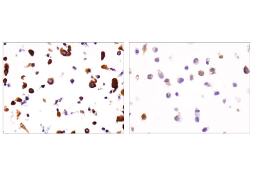 Immunohistochemistry Image 4: DCLK1/DCAMKL1 (D2U3L) Rabbit Monoclonal Antibody