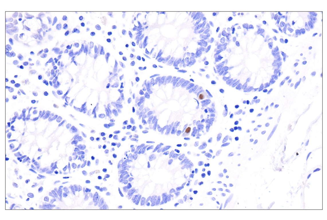 Immunohistochemistry Image 8: INSM1 (BLR272L) Rabbit Monoclonal Antibody
