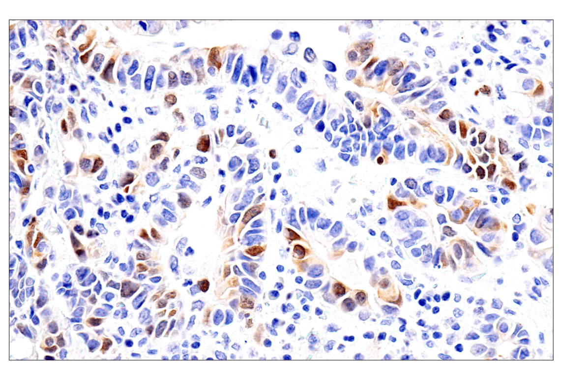 Immunohistochemistry Image 4: Chk1 (2G1D5) Mouse mAb