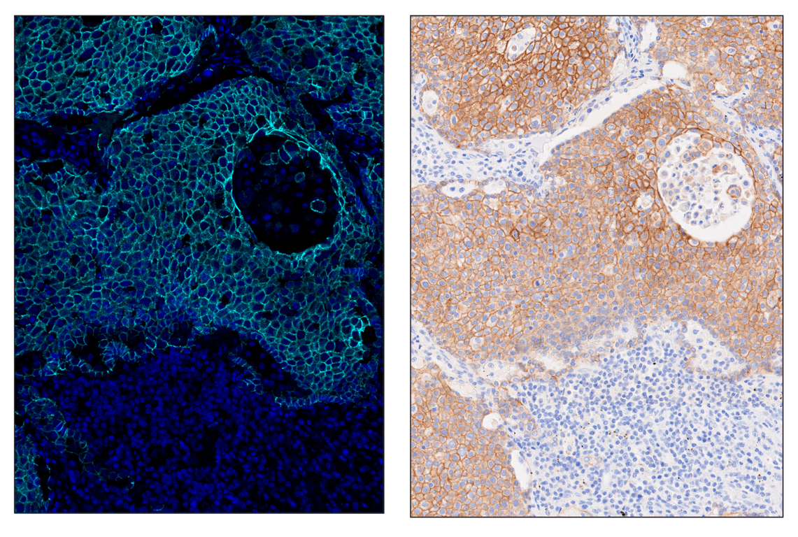 Immunohistochemistry Image 6: E-Cadherin (24E10) & CO-0103-647 SignalStar<sup>™</sup> Oligo-Antibody Pair