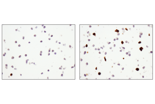Immunohistochemistry Image 3: Cleaved PARP (Asp214) (D6X6X) Rabbit Monoclonal Antibody