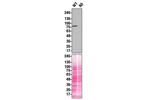 undefined Image 26: Xenophagy Antibody Sampler Kit