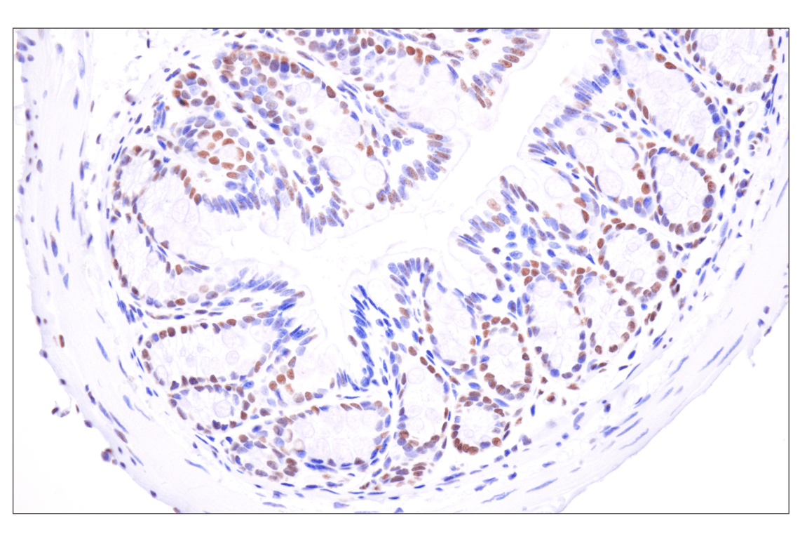 Immunohistochemistry Image 10: Acetyl-Histone H4 (Lys16) (E2B8W) Rabbit Monoclonal Antibody (BSA and Azide Free)
