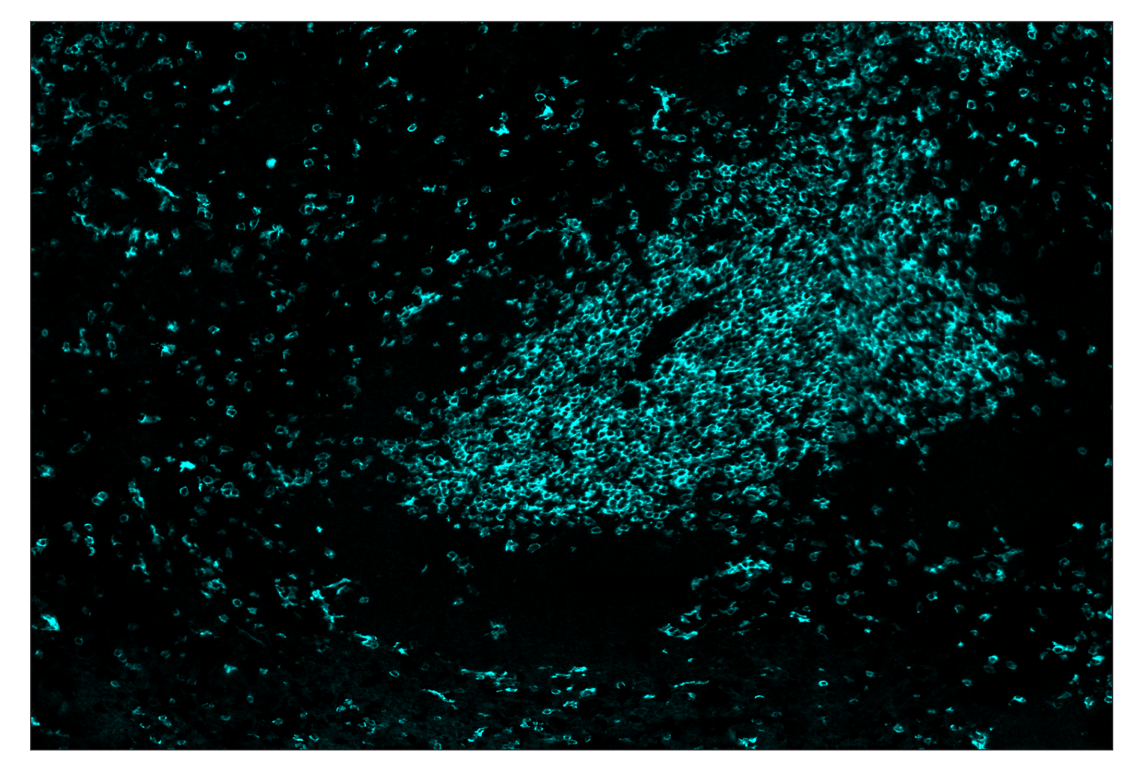 Immunohistochemistry Image 5: CD8α (D4W2Z) & CO-0040-647 SignalStar<sup>™</sup> Oligo-Antibody Pair