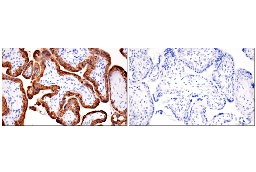 Immunohistochemistry Image 6: Pan-Keratin (5D3/LP34) Mouse Monoclonal Antibody